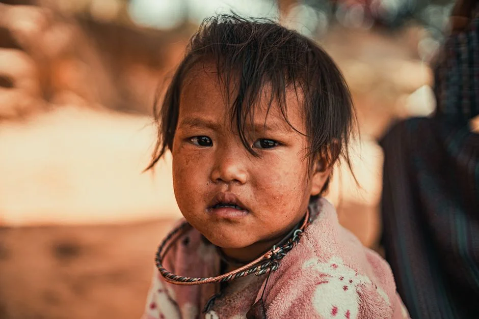 Bangladesh Measles Outbreak Kills 200 Children in Three Months — Entertainment